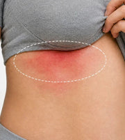 Antifungal Barrier Cream